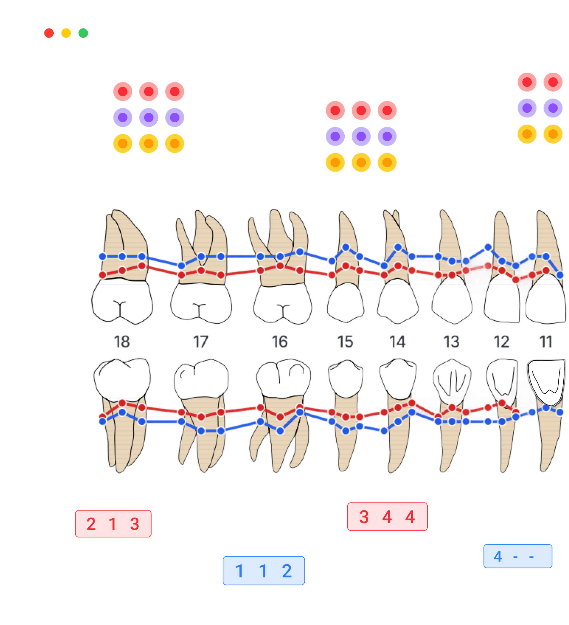 Free Perio Chart Online — Periodontal Charting Zermmi Perio